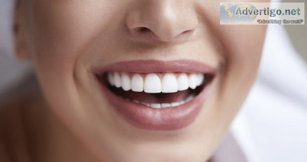 Teeth whitening dubai