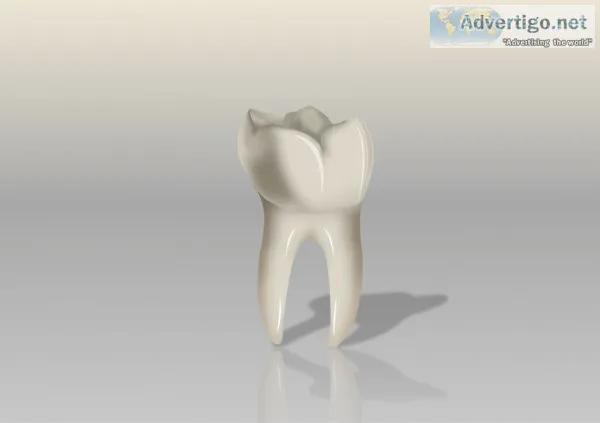 Dental implant