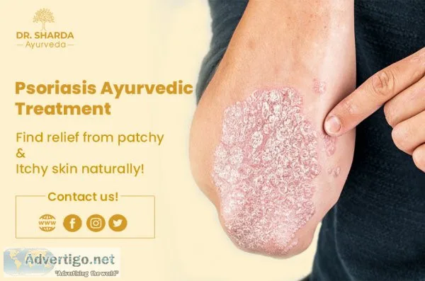 Psoriasis ayurvedic treatment centre