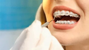 Orthodontist for tooth, jaw alignment in thakur village