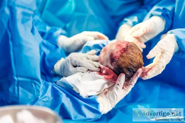The best birth injury lawyers in california