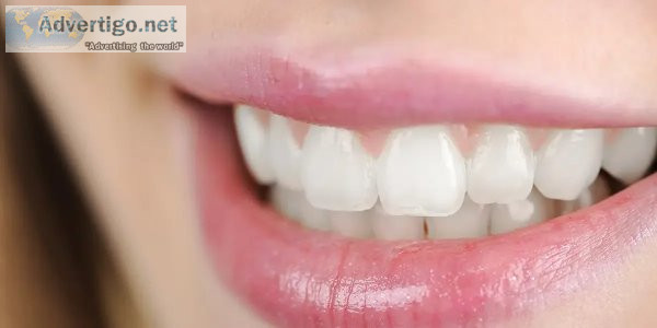 Cosmetic dentistry