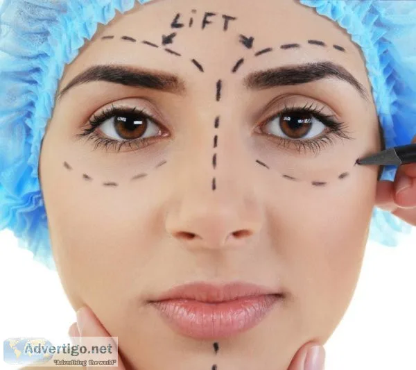 Brow lift london