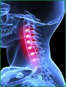 Neck pain relief