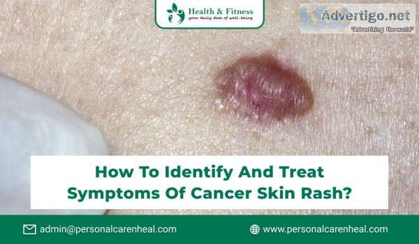 Here you know about different types of cancer that may causes sk