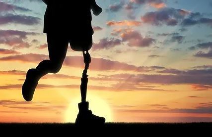 Get reliable prosthetics services in singapore