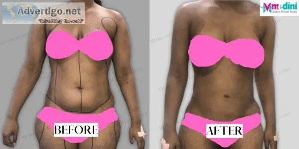Medini cosmetic surgery