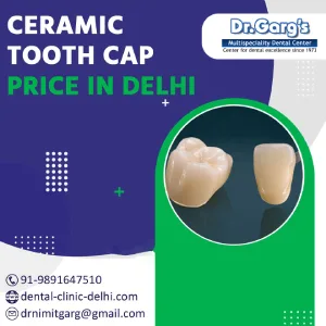 Ceramic tooth cap price in delhi