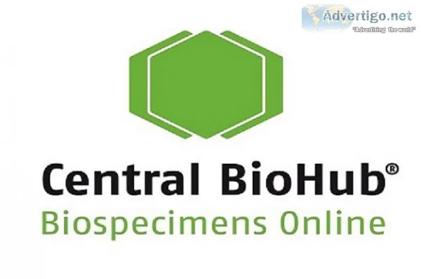 Patient samples for biomedical research | order online