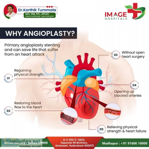 Angioplasty treatment in ameerpet