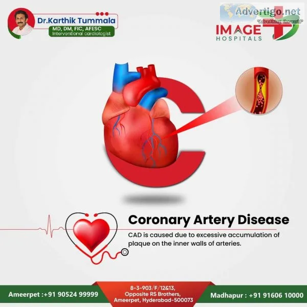 Heart specialist in ameerpet