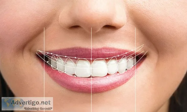 Digital smile design