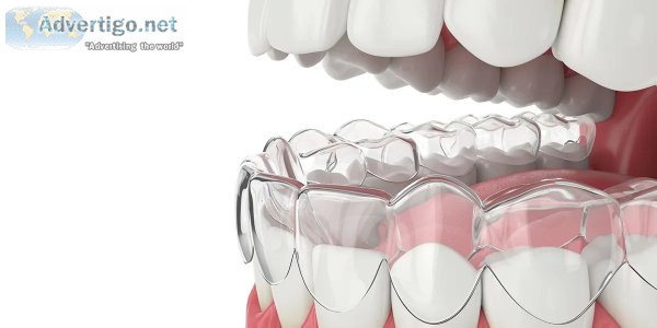 Invisalign dentist in new york city