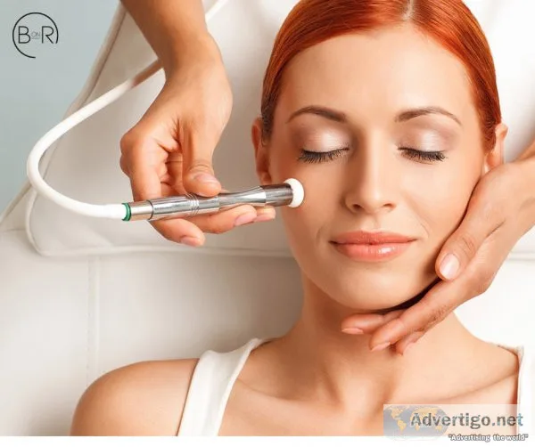 Microdermabrasion skin treatment in essendon melbourne