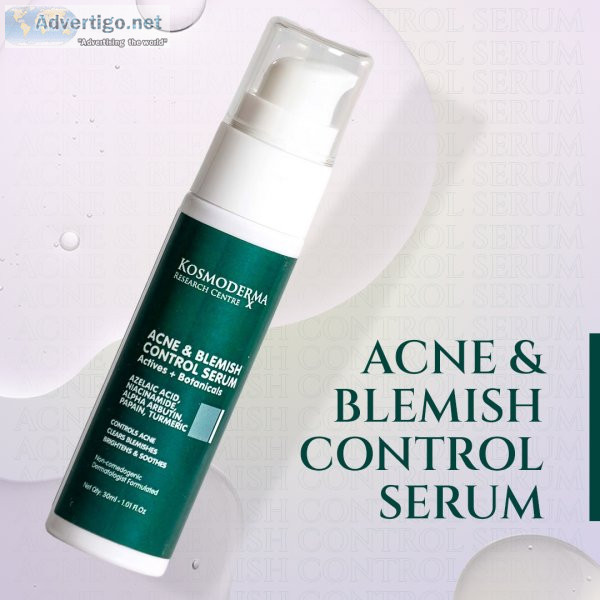Niacinamide acne & blemish control serum | pigmentation serum fo