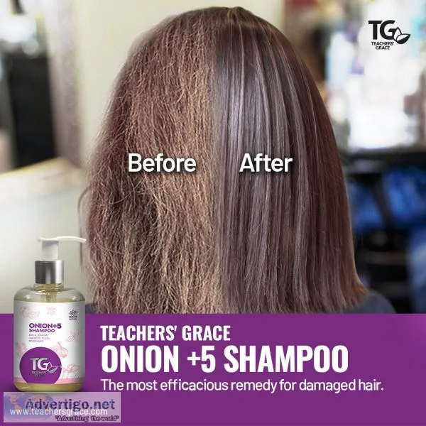 Best hair fall shampoo for women