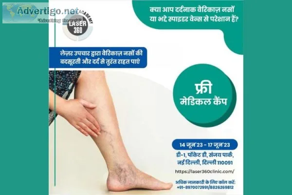 Advanced varicose vein laser surgery at laser 360 clinic