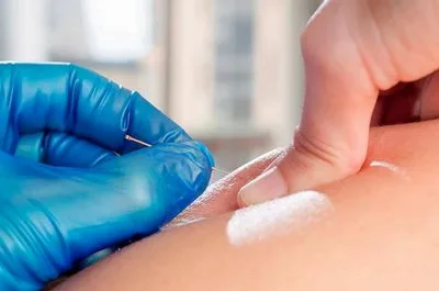 About ims/dry needling therapy