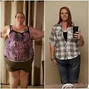 The leanbiome revolution: achieve sustainable weight loss with o