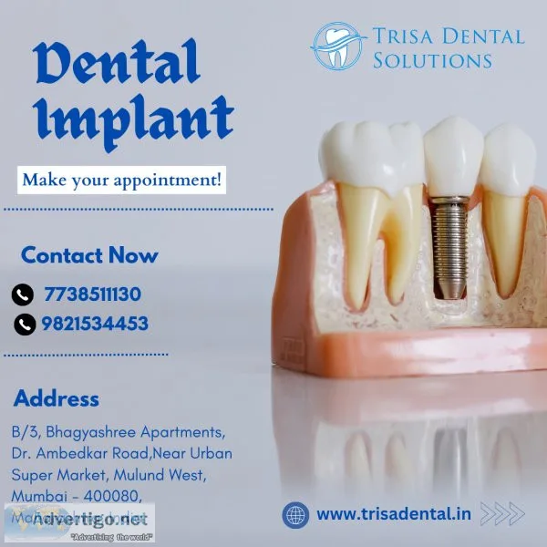 Trisa Dental Solutions : Best Dental Implants in Mumbai