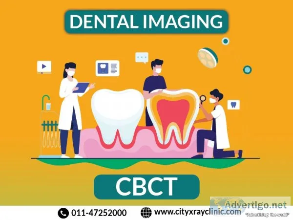 Cbct scan near near me in delhi at affordable price