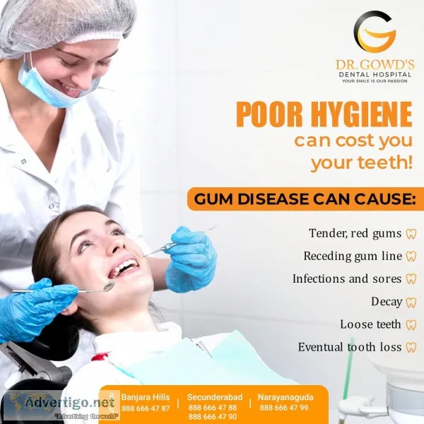 Best dental implants in hyderabad