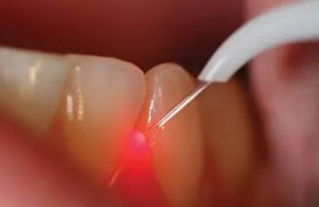 Best cosmetic dentist in hyderabad
