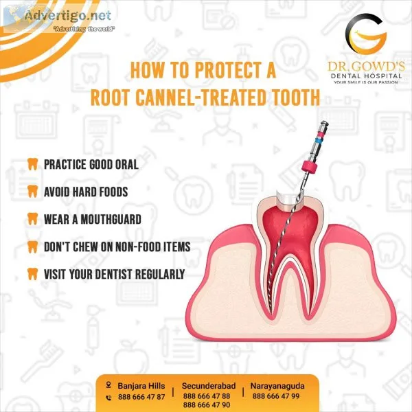 Single sitting root canal treatment in hyderabad