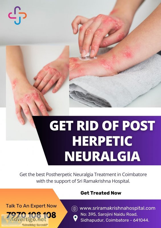 Postherpetic neuralgia specialist in coimbatore | sri ramakrishn