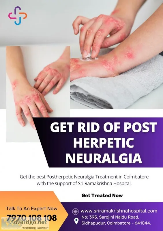 Postherpetic neuralgia specialist in coimbatore | sri ramakrishn
