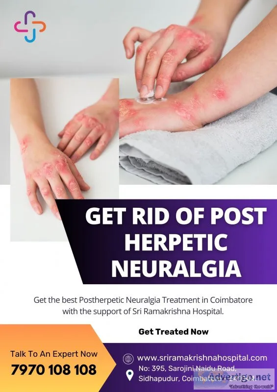 Postherpetic neuralgia specialist in coimbatore | sri ramakrishn
