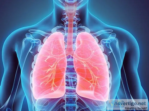 Ayurvedic pleurisy treatment in delhi ncr