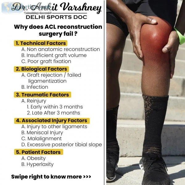 Best doctor for Sports Injury Treatment in Delhi | Dr Ankit Vars