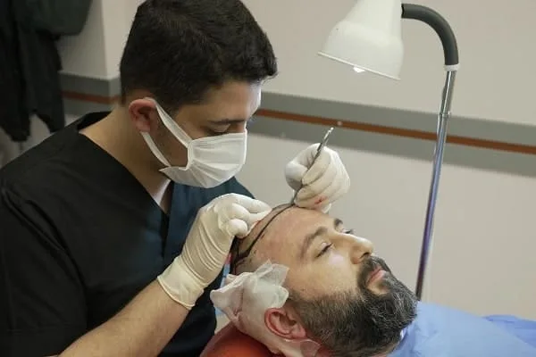 Get natural hair restoration in lucknow