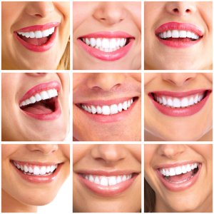 Visit cosmetic dentist montebello for perfect smile
