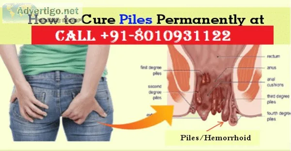 Piles treatment in west delhi without surgery