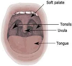Natural ways to make tonsil stones fall out