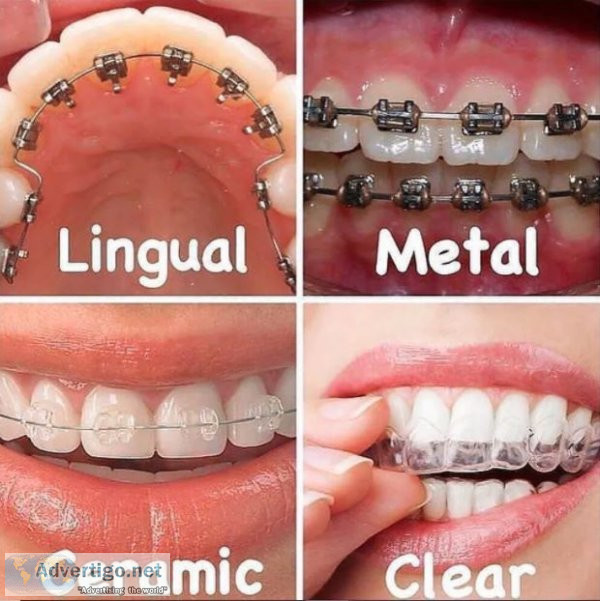 The best orthodontist in pune shivajinagar: vanilla smiles shine