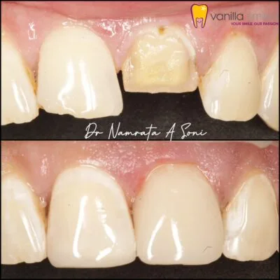 Vanilla smile: your ultimate destination for the best dental cro