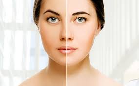Achieve radiant skin with skin whitening treatment in pune at th