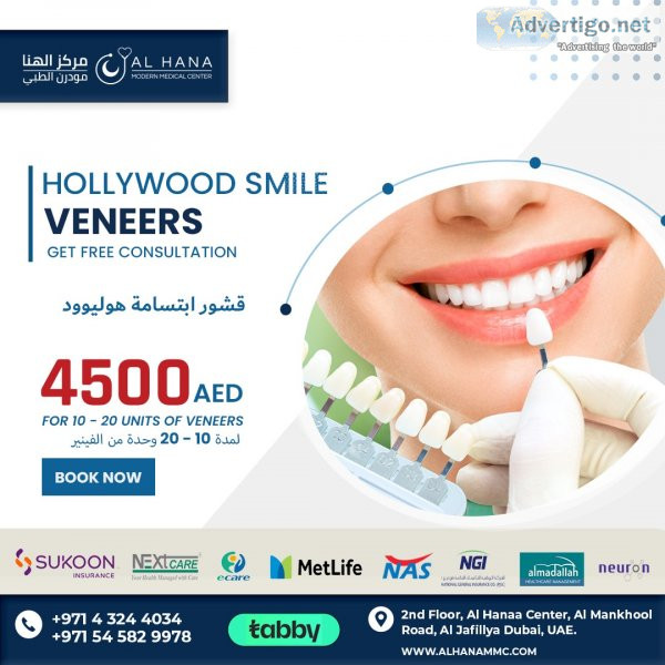 Dental veneers