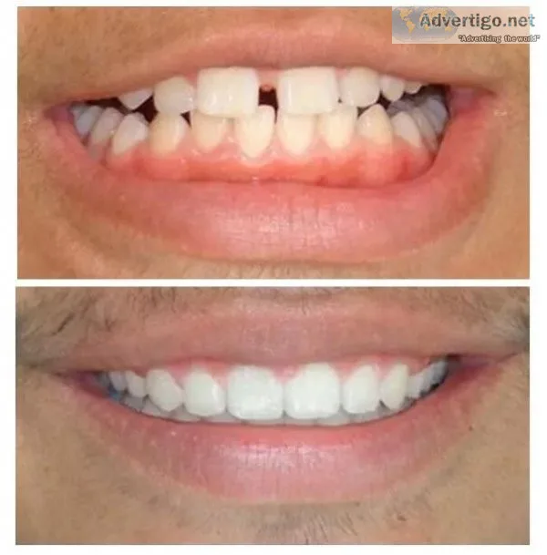 Best dental clinic in delhi