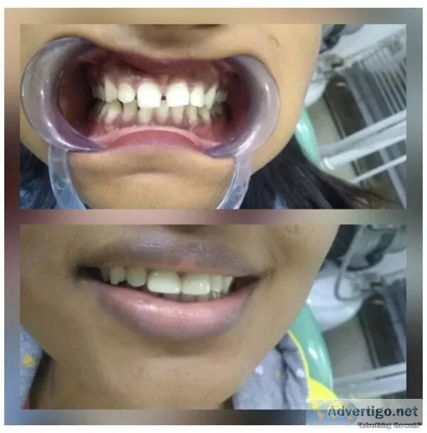 Top dentist in delhi - north delhi dental clinic