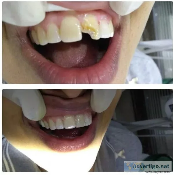Best dental clinic in delhi