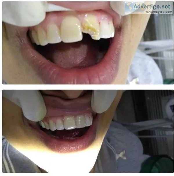 Top dentist in delhi - north delhi dental clinic