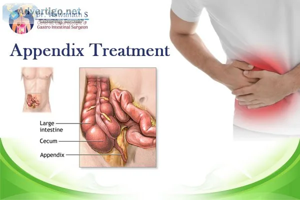 Dr viswanth: sarjapur road appendix surgery specialist