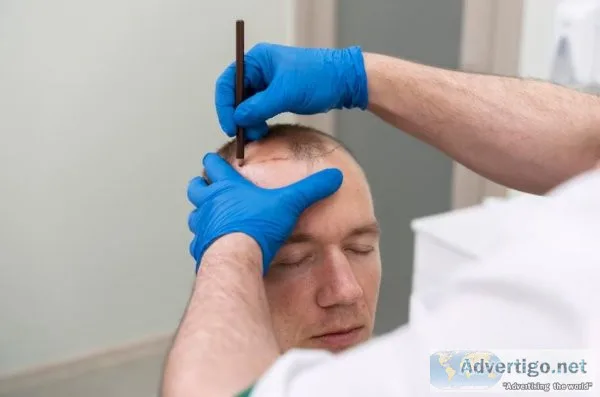 Best hair specialist in ahmedabad, india