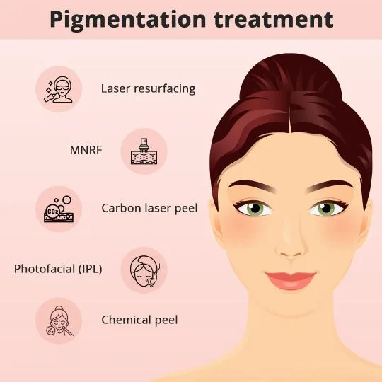 Pigmentation treatment in hyderabad