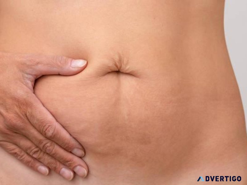 GallstonesCausesSy mptoms and Treatment Options