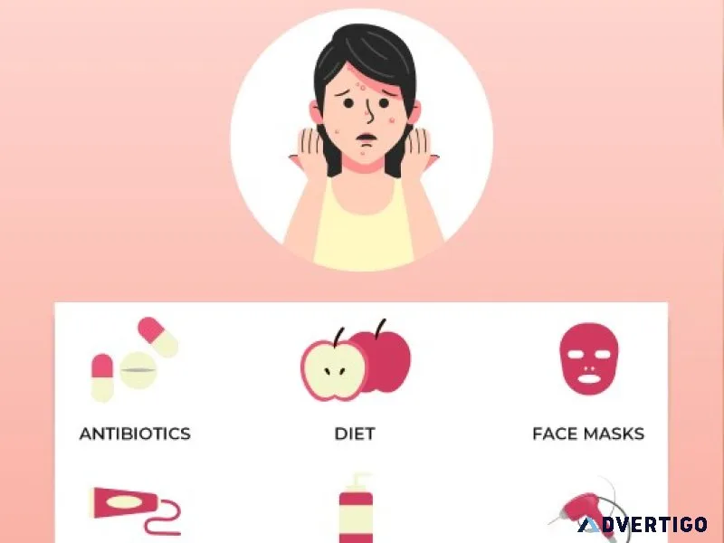 Acne treatment in hyderabad